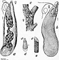 EB1911 Hemiptera - Fig. 13.—Apple Scale Insect (Mytilaspis pomorum)