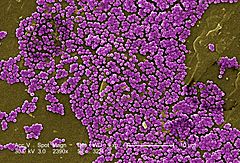 Methicillin-resistant Staphylococcus aureus 10047.jpg