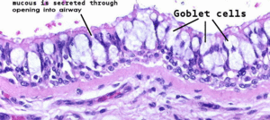 Goblet cell hyperplasia-2