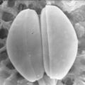 Pennate diatoms (3075304186)