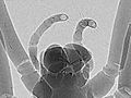 Phase-contrast x-ray image of spider