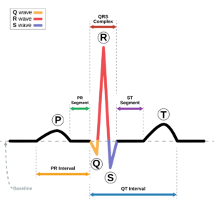 SinusRhythmLabels