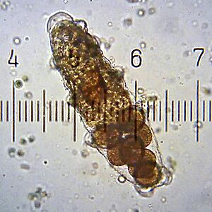 TardigradeEggsInShedCuticle