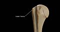 Greater-Tubercle-of-Right-Humerus