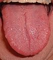 Tongue.agr