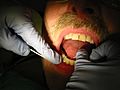 Dental flossing 9344