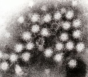Norovirus 4