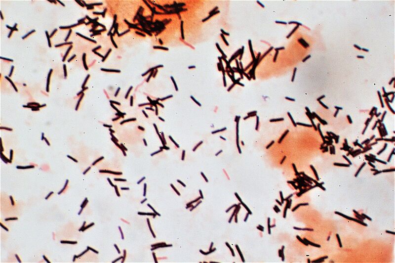 Lactobacilli (Gram stain)
