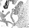 Dengue