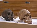 H-floresiensis-Cretan-microcephalic