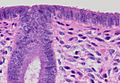 Histology of normal simple columnar epithelium of the endometrium