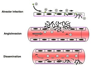 Aspergillus fumigatus Invasive Disease Mechanism Diagram