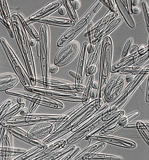 Chironex fleckeri nematocysts 01