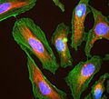 HeLa cells stained with antibody to actin (green) , vimentin (red) and DNA (blue)