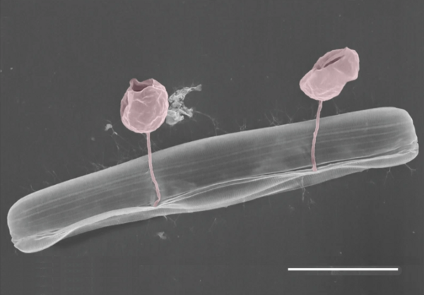 Pennate diatom infected with two chytrid-like fungal pathogens