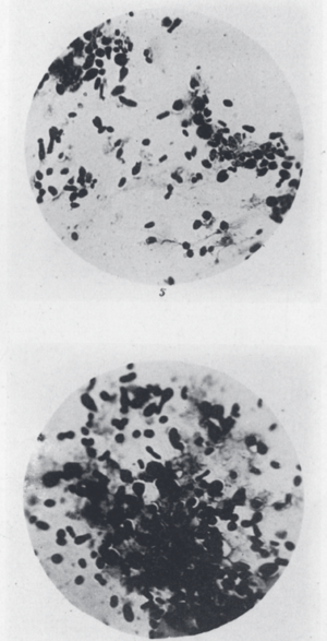 Preparações de Ricardo Jorge do bacilo da peste bubónica no Porto (1899) - fotografias de António Plácido da Costa (Museu de História da Medicina Maximiano Lemos, FMUP)