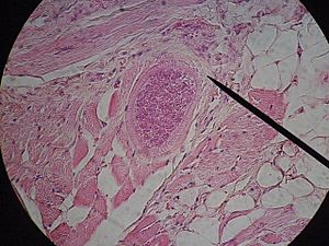 Sarcocystis in pig muscle
