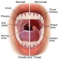 Blausen 0860 Tonsils&Throat Anatomy