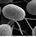 Chlamydomonas (10000x)
