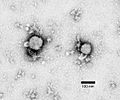 Lymphocytic choriomeningitis virus