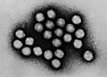 Adenovirus transmission electron micrograph B82-0142 lores