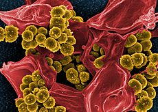 Scanning electron micrograph of Methicillin-resistant Staphylococcus aureus (MRSA) and a dead Human neutrophil - NIAID
