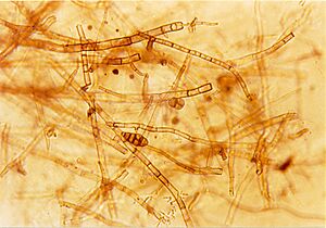 Septate hyphae of the fungus Alternaria sp