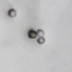 Pollens of Acalypha indica 2