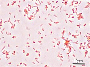 Salmonella Typhimurium Gram