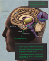 Alzheimers entorhinal cortex