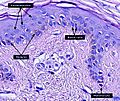 Micrograph of keratinocytes, basal cells and melanocytes in the epidermis