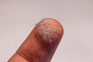 Hausstaub auf einem Finger