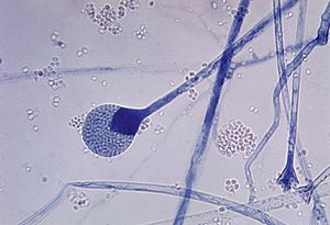 Mature sporangium of a Mucor sp. fungus