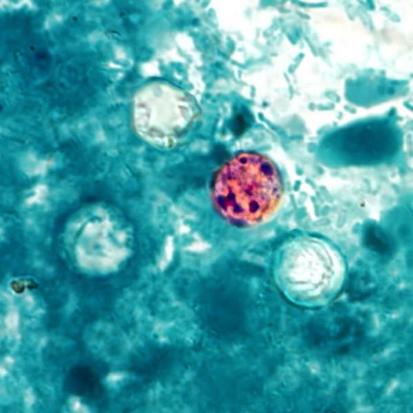 Cyclospora cayetanensis