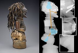 Detailed Radiographic Image of an African Songye Power Figure in the collection of the Indianapolis Museum of Art (2005.21)
