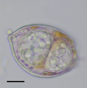 Dinovorax pyriformis PMC5609580 fig1c