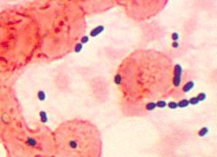 Enterococcus histological pneumonia 01.png