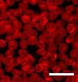 Sedimented red blood cells