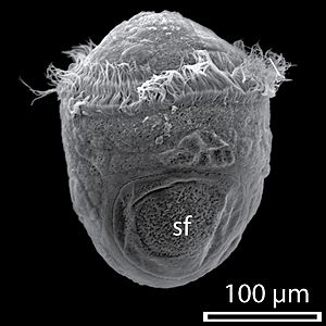 Haliotis asinina trochophore