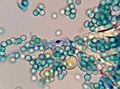 Unknown fruit mold with spores methylene blue x2000