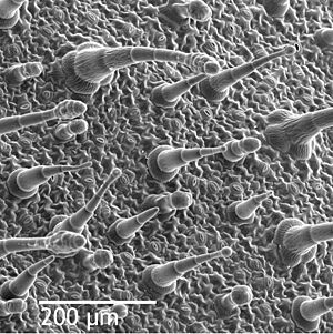Leaf epidermis w scale