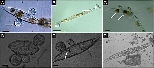 Chytrid parasites of marine diatoms