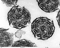 Bronchiolar area cilia cross-sections 2