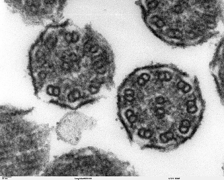 Bronchiolar area cilia cross-sections 2