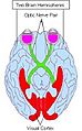 Optic nerve pair & two brain hemispheres