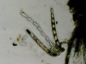 Pertusaria paratuberculifera (EU1)