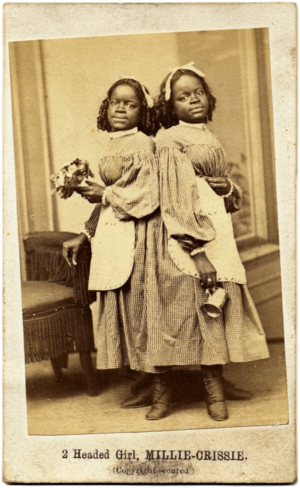 Millie and Christine McKoy by Fitzgibbon, 1867