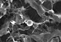 DDC-SEM of calcified particle in cardiac tissue - BW - 2
