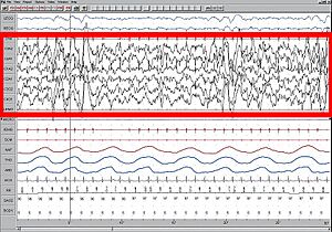 Sleep EEG Stage 4