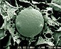 CSIRO ScienceImage 1392 Scanning Electron Micrograph of Chytrid Fungus